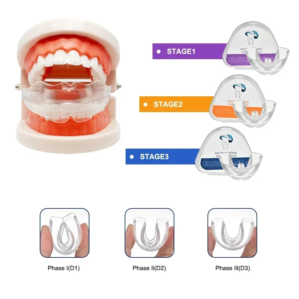 3-Stage Transparent Teeth Aligners - Orthodontic Dental Braces for Adults, DIY Tooth Straightening Corrector Kit Peaceful Pleasures Health and Wellness