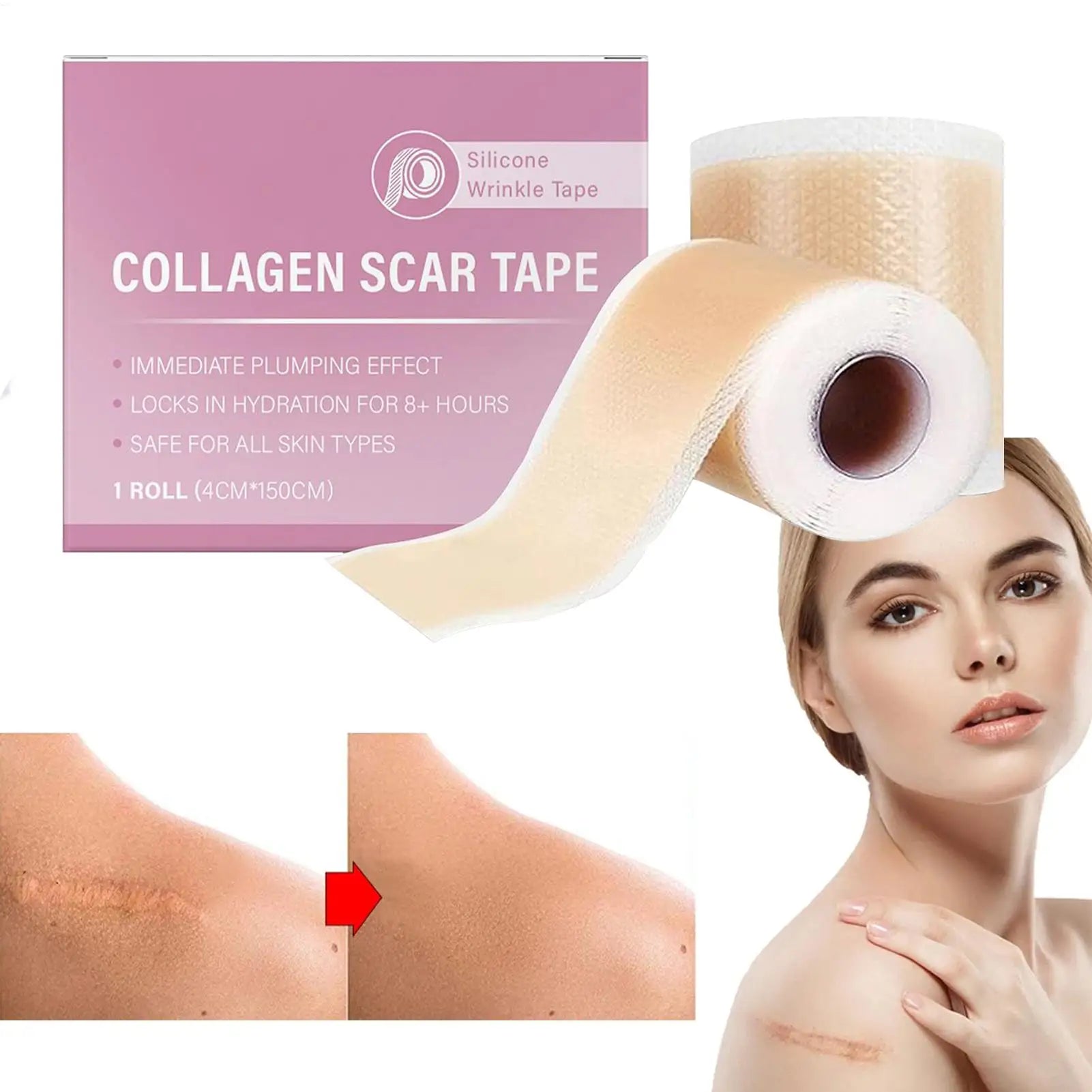 Scar Sheets 1 Roll Self-Adhesive Scar Cover Tape Skin Care Waterproof and Breathable Peaceful Pleasures Health and Wellness