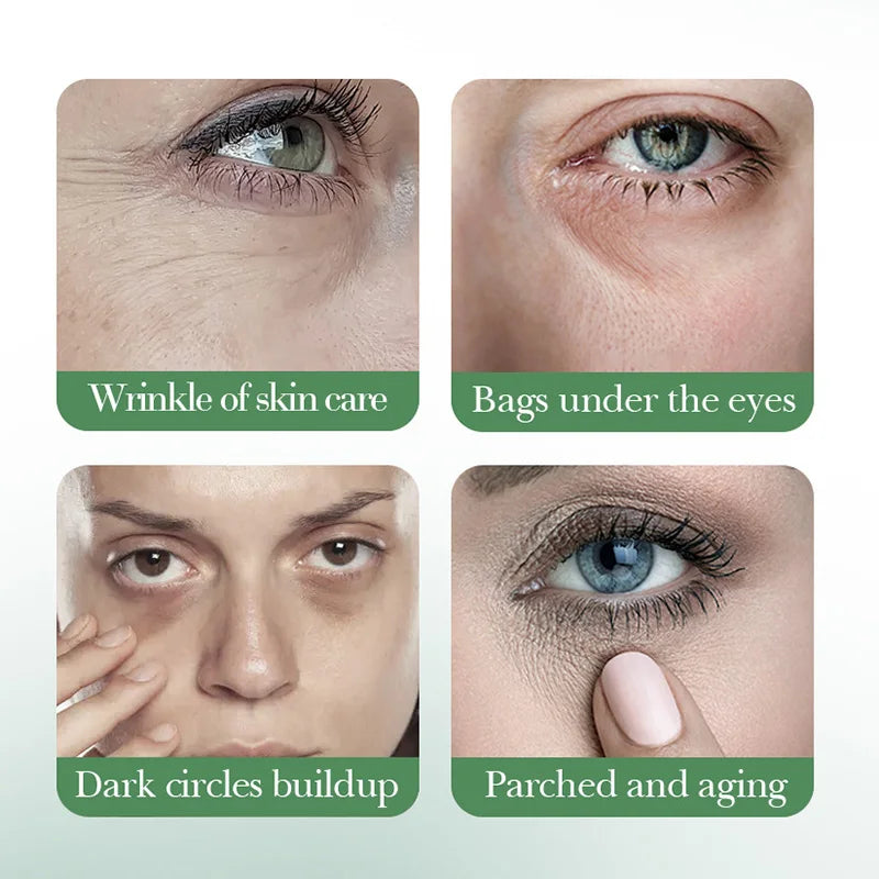 SADOER Centella Asiatica Eye Cream – Dark Circles & Bags
