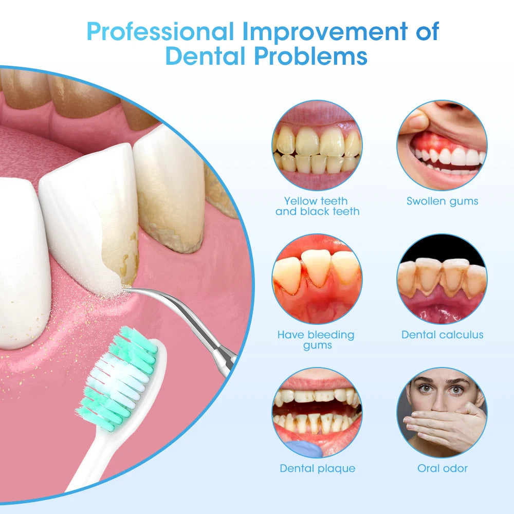 Electric Teeth Cleaner Dental Remover Calculus Plaque Stains and Tartar Oral Care Teeth Whitening Kits Rechargeable Toothbrush Peaceful Pleasures Health and Wellness