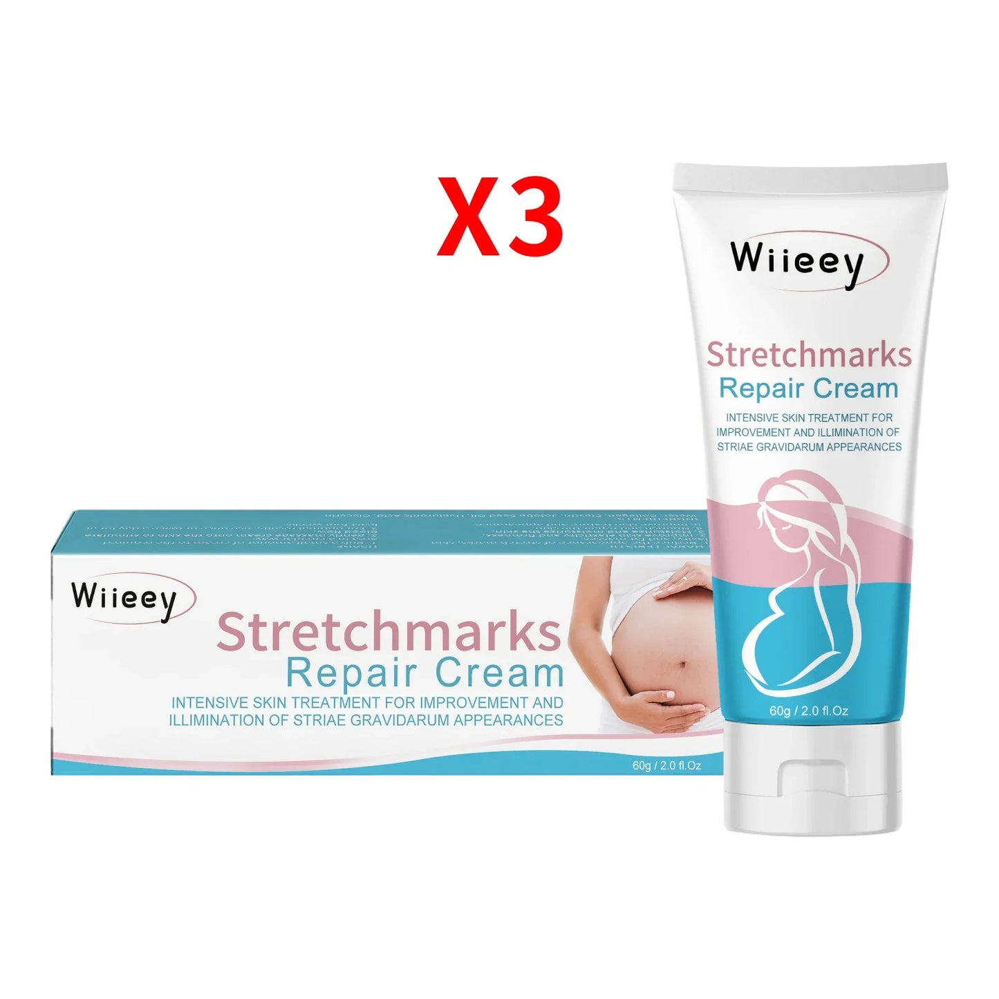 Wiieey Stretch Mark Cream – Firm, Hydrate & Restore Skin