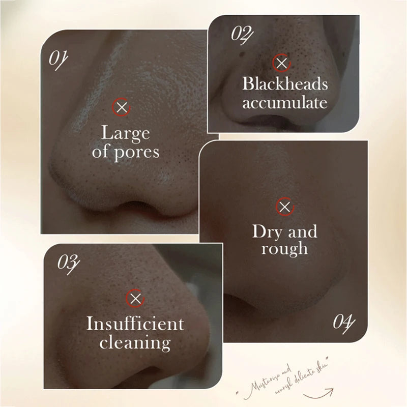 White Rice Blackhead Removal Nose Mask – Oil Control & Whitening