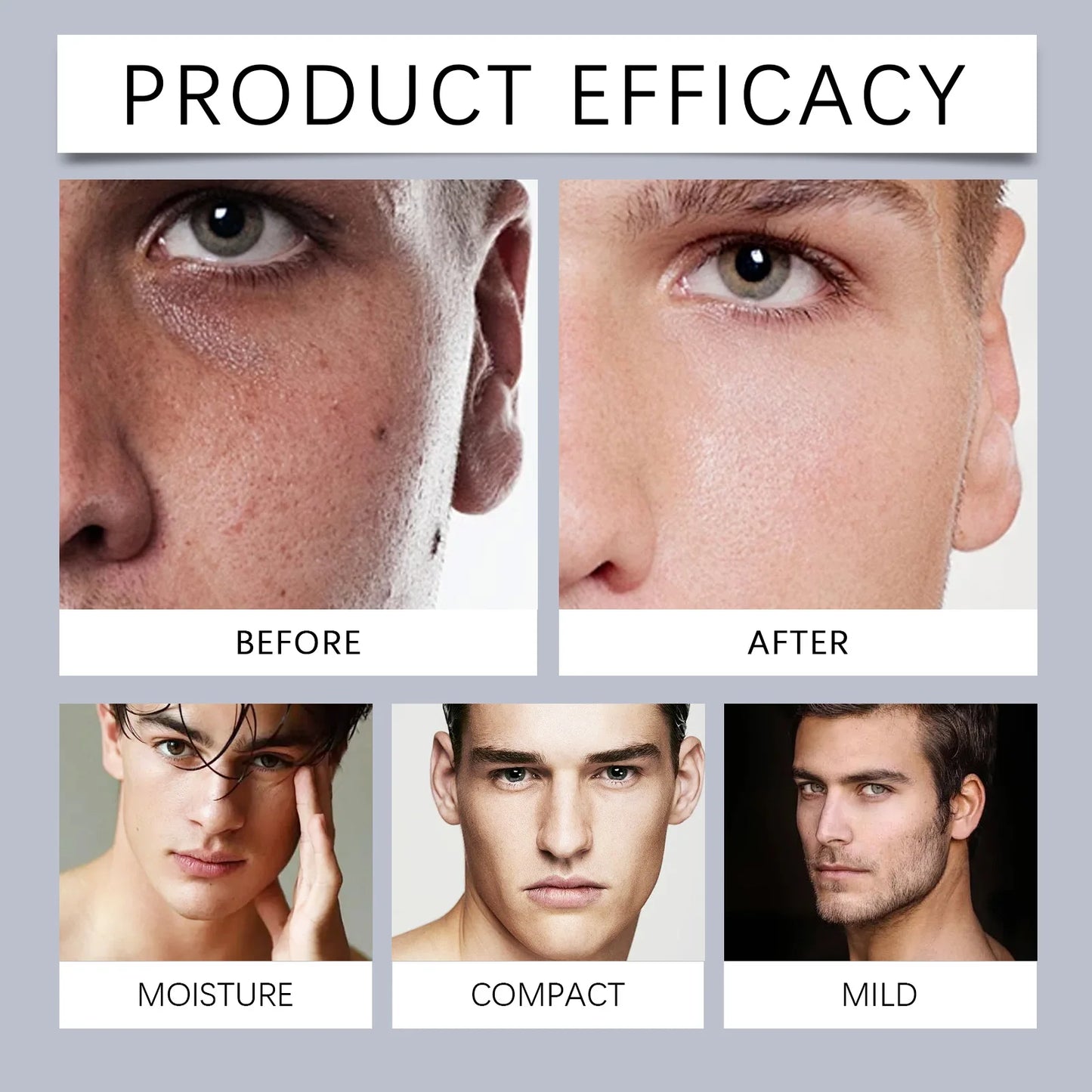 East Moon Collagen Scar Gel – Moisturize & Smooth Skin 30g