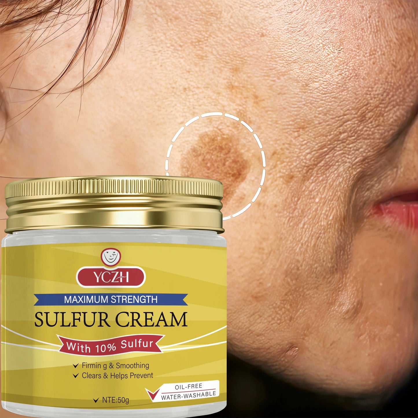 YCHZ Sulfur Cream – Pore Minimizing, Firming & Oil Control 50g