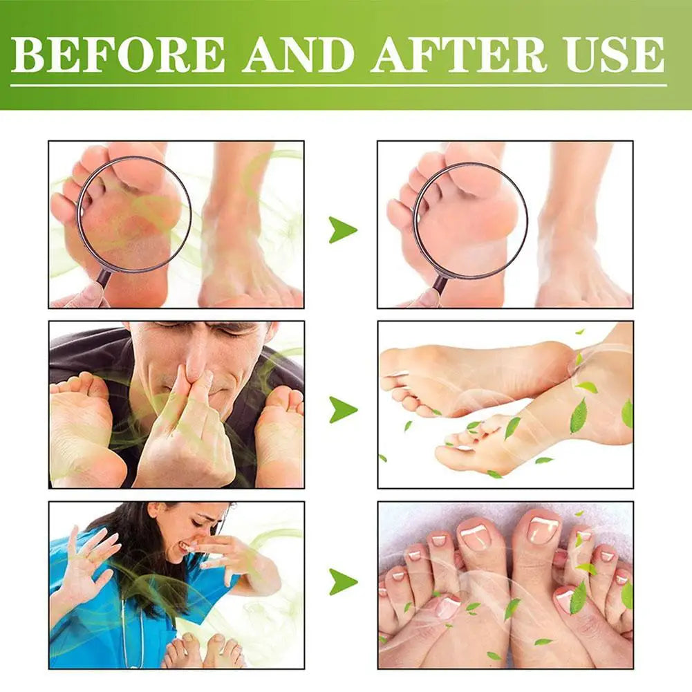 Fresh Foot & Shoe Deodorant Spray – Natural Odor Control 30ml Foot Deodorant Spray Peaceful Pleasures Health and Wellness