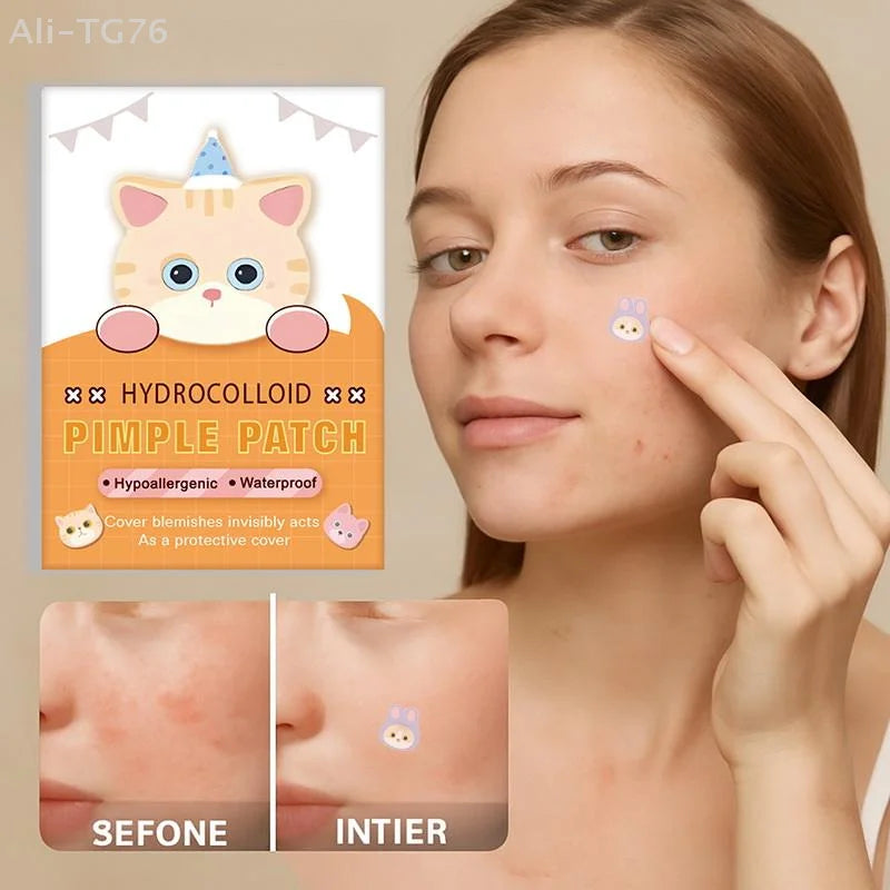 600 Cat-Shaped Hydrocolloid Acne Patches | Colorful Pimple Stickers
