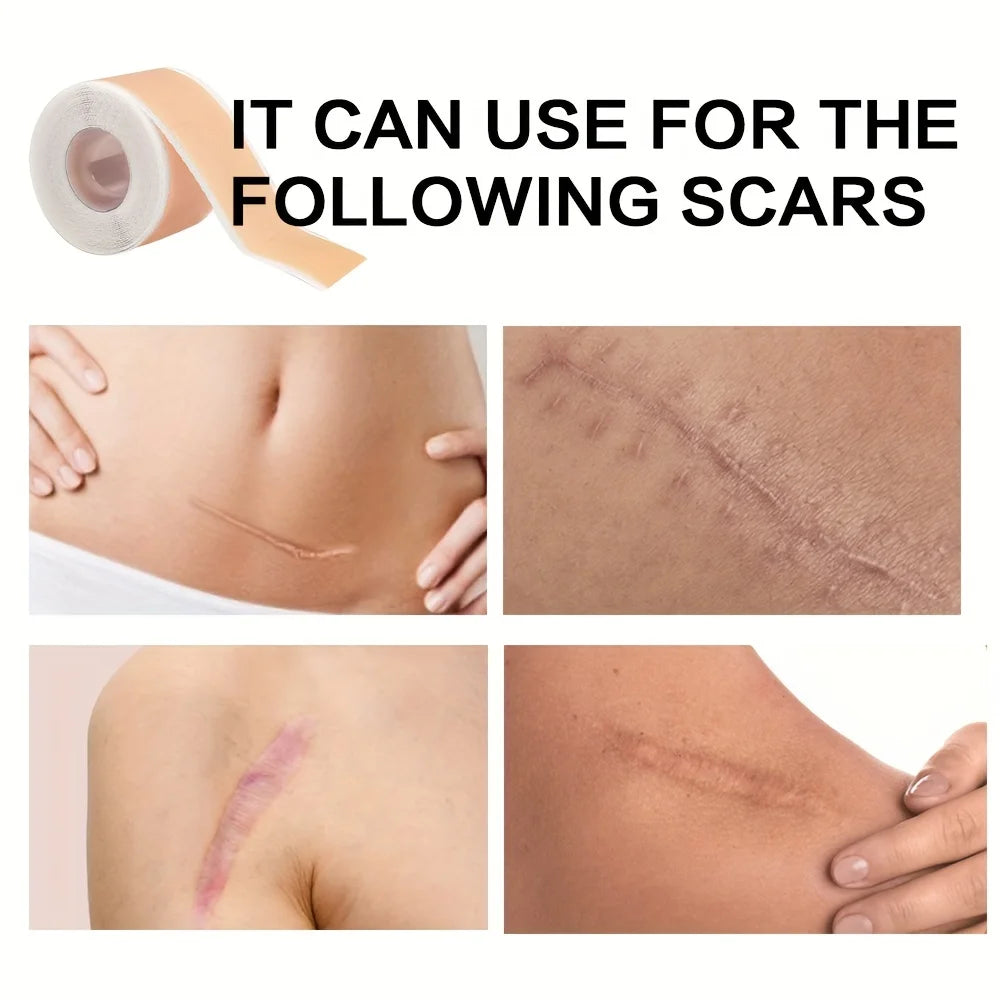 Scars Covering Patch,Invisible Silicone Patch,Skin Care Covering Patch 150cm(59.1in) Peaceful Pleasures Health and Wellness