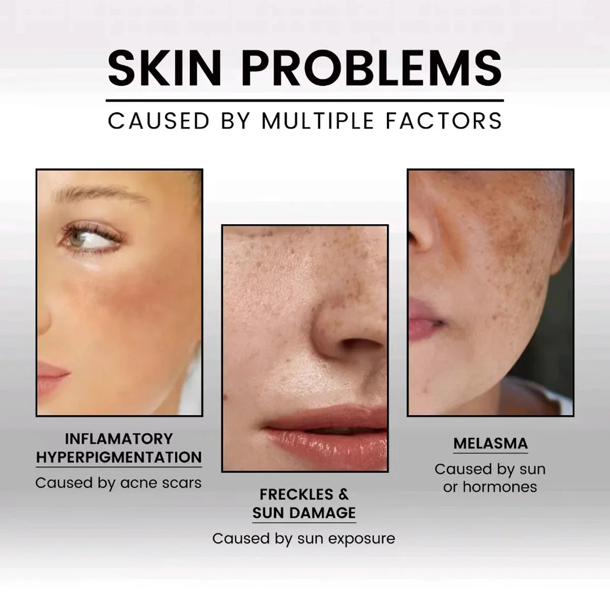 Pure Vitamin E & Avocado Oil Moisturizing Serum – Face & Body