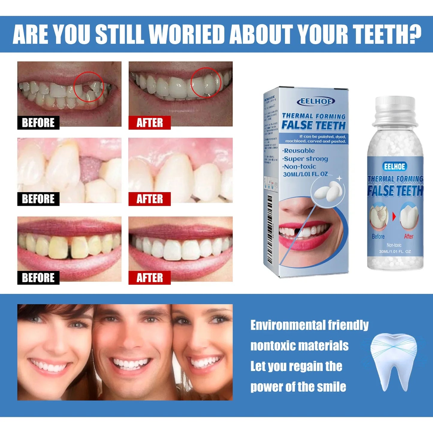 EELHOE Temporary Tooth Repair Kit – Gap & Chip Filler 30ml