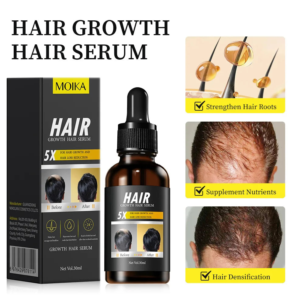 Mint Hair Growth Oil – Root Nourishing Scalp Treatment 30ml