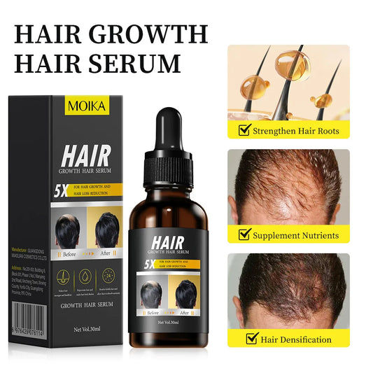 Mint Hair Growth Oil – Root Nourishing Scalp Treatment 30ml Hair Growth Oil Oasis Select