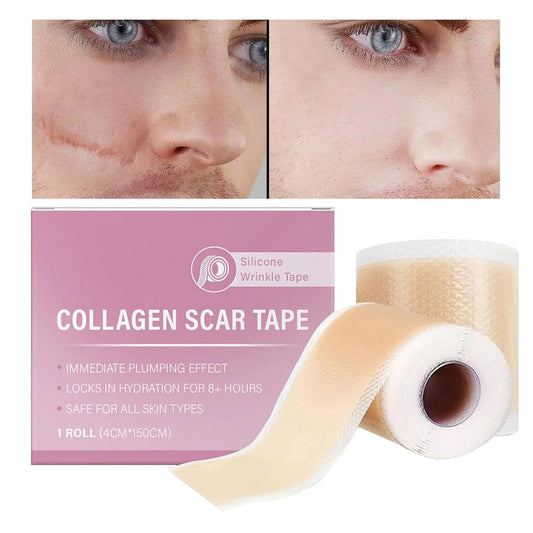 Scar Sheets 1 Roll Self-Adhesive Scar Cover Tape Skin Care Waterproof and Breathable Peaceful Pleasures Health and Wellness