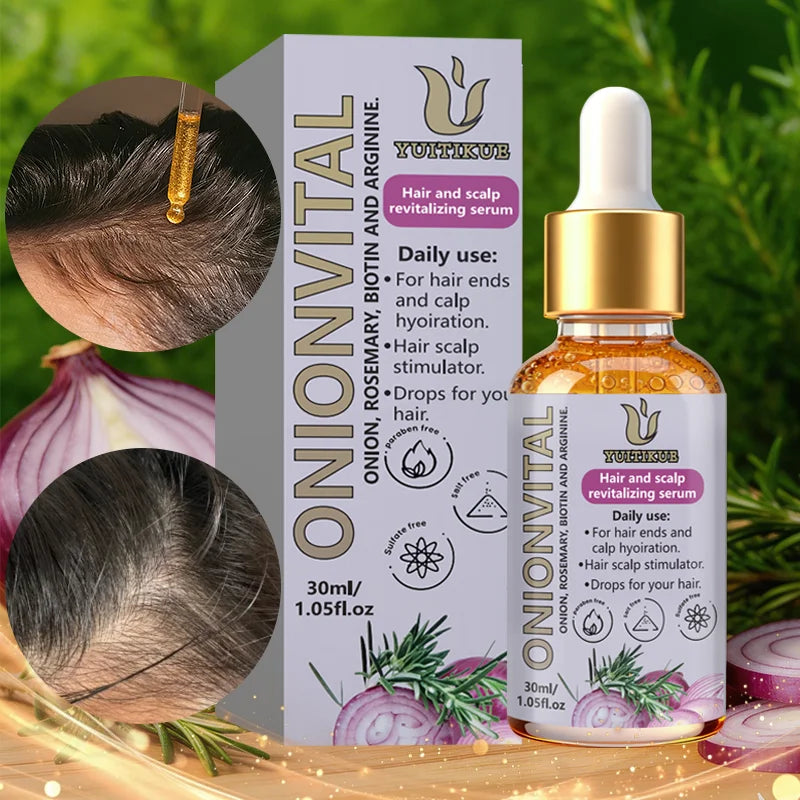 YUITIKUE Onionvital Hair Serum | Onion, Rosemary & Biotin Formula | For Scalp & Hair Ends Hydration 30ml Peaceful Pleasures Health and Wellness