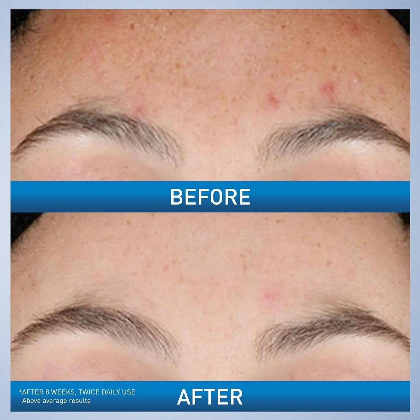 CeraVe Retinol Serum – Niacinamide, Ceramides & Licorice Root