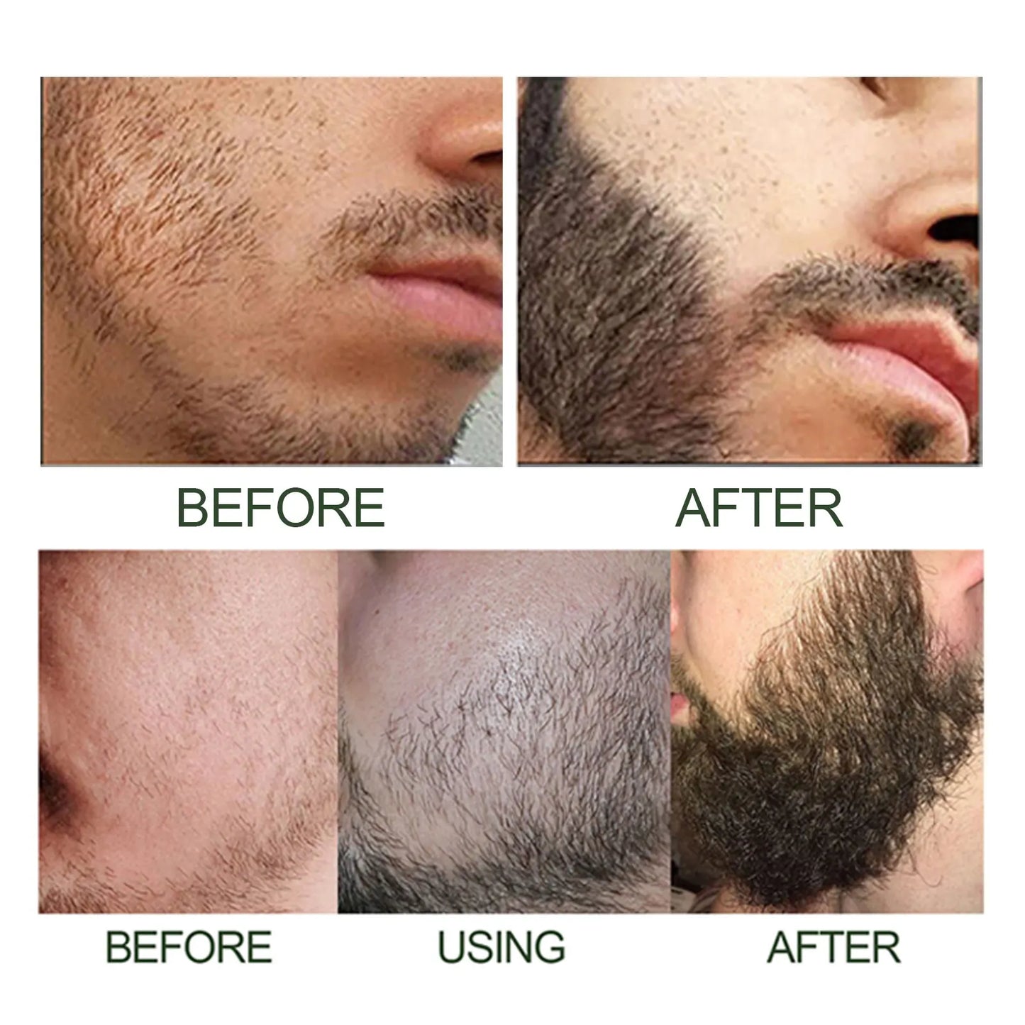 Beard Growth Serum Kit + 0.2mm Derma Roller | Fuller Beard