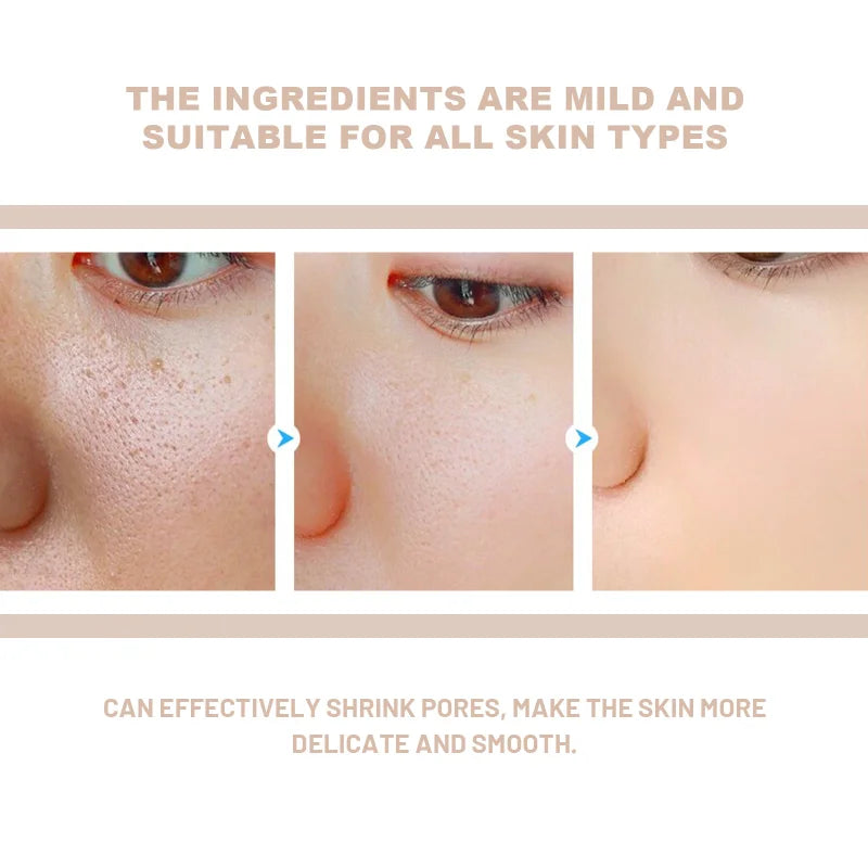 Exfoliating Gel Scrub – Deep Clean Face & Body, Unclog Pores