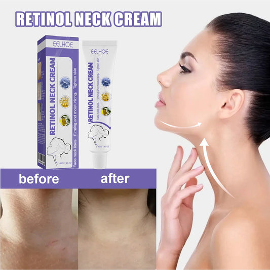 Retinol Neck Firming Cream – Moisturizing & Smoothing 40ml Neck Firming Cream Oasis Select