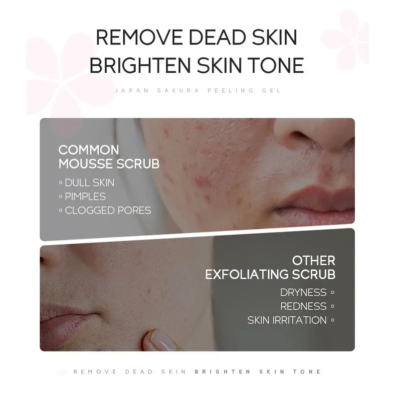 LAIKOU Sakura Peeling Gel Facial Exfoliation Cleans Pores Moisturizing Oil Control 60g Peaceful Pleasures Health and Wellness