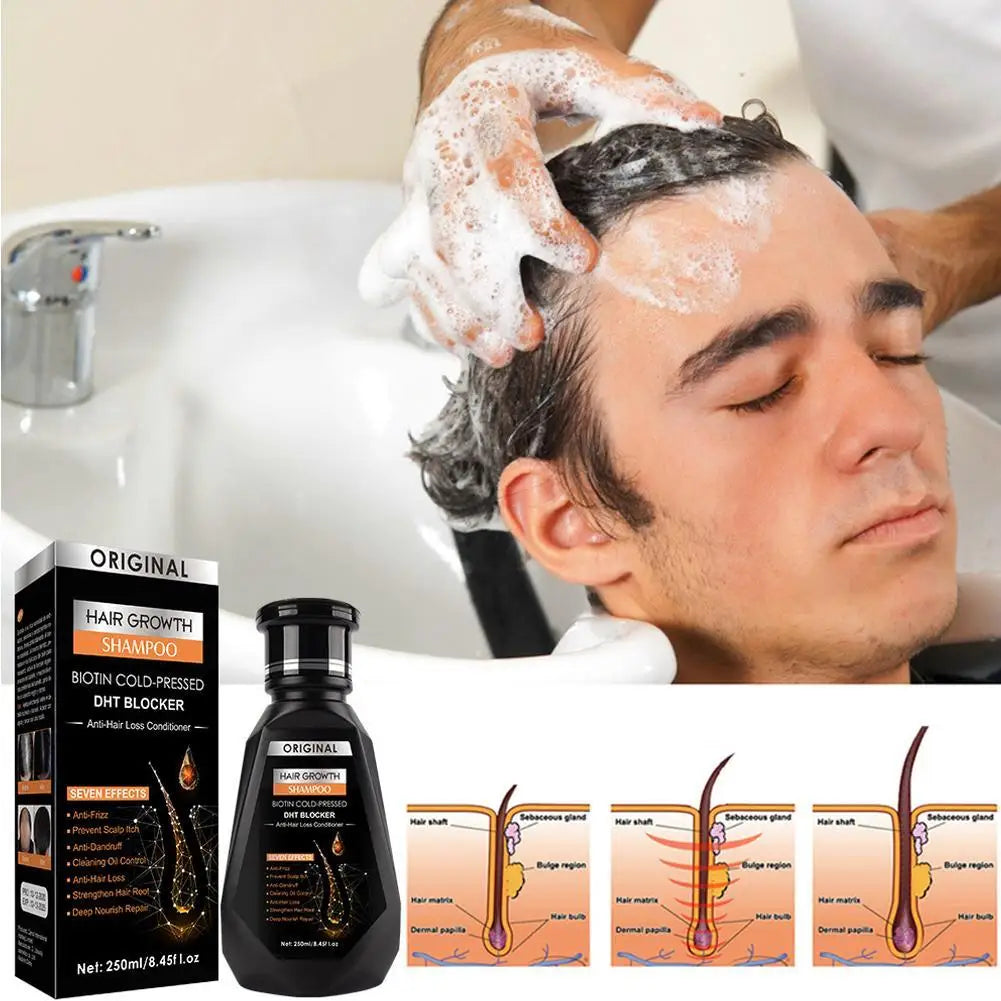 Ginger Hair Growth Shampoo Deep Cleaning Relieves Itching Stimulates Hair Follicles and Accelerates Hair Growth Shampoo Peaceful Pleasures Health and Wellness