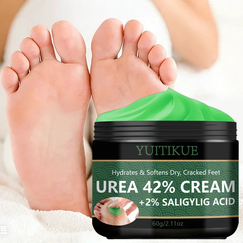 YUITIKUE 42% Urea Foot Cream – Softens Calluses & Hydrates