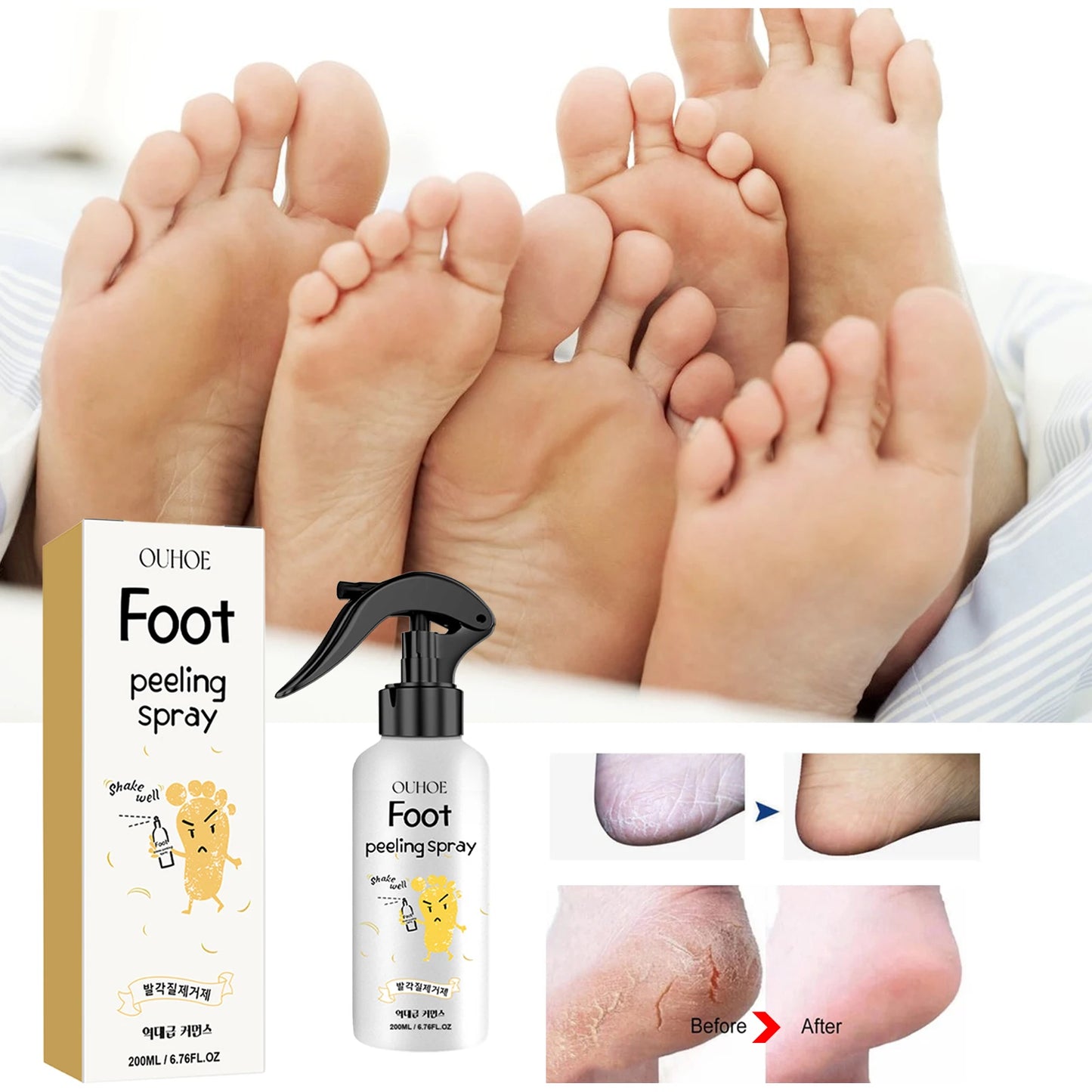 Ouhoe Foot Callus Remover Spray | 72H Moisture & Exfoliation