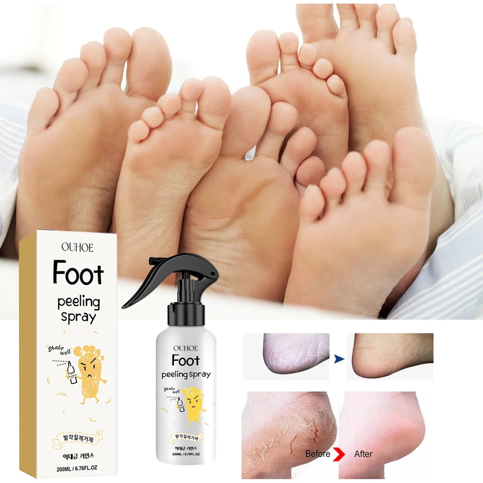 Ouhoe Foot Callus Remover Spray – 72H Hydration & Exfoliation Foot Care Spray Oasis Select