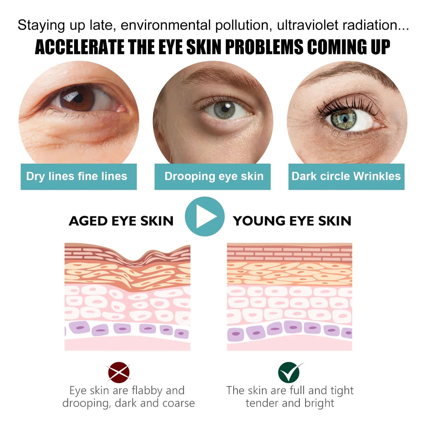 EELHOE Hyaluronic Acid Eye Cream – Dark Circles & Eye Bags 5pc
