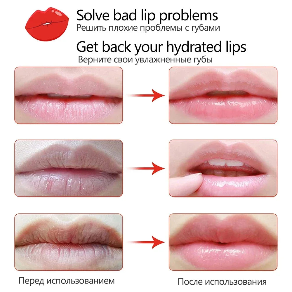Vitamin C Lip Mask Patches – Moisturizing & Smoothing | 20pc