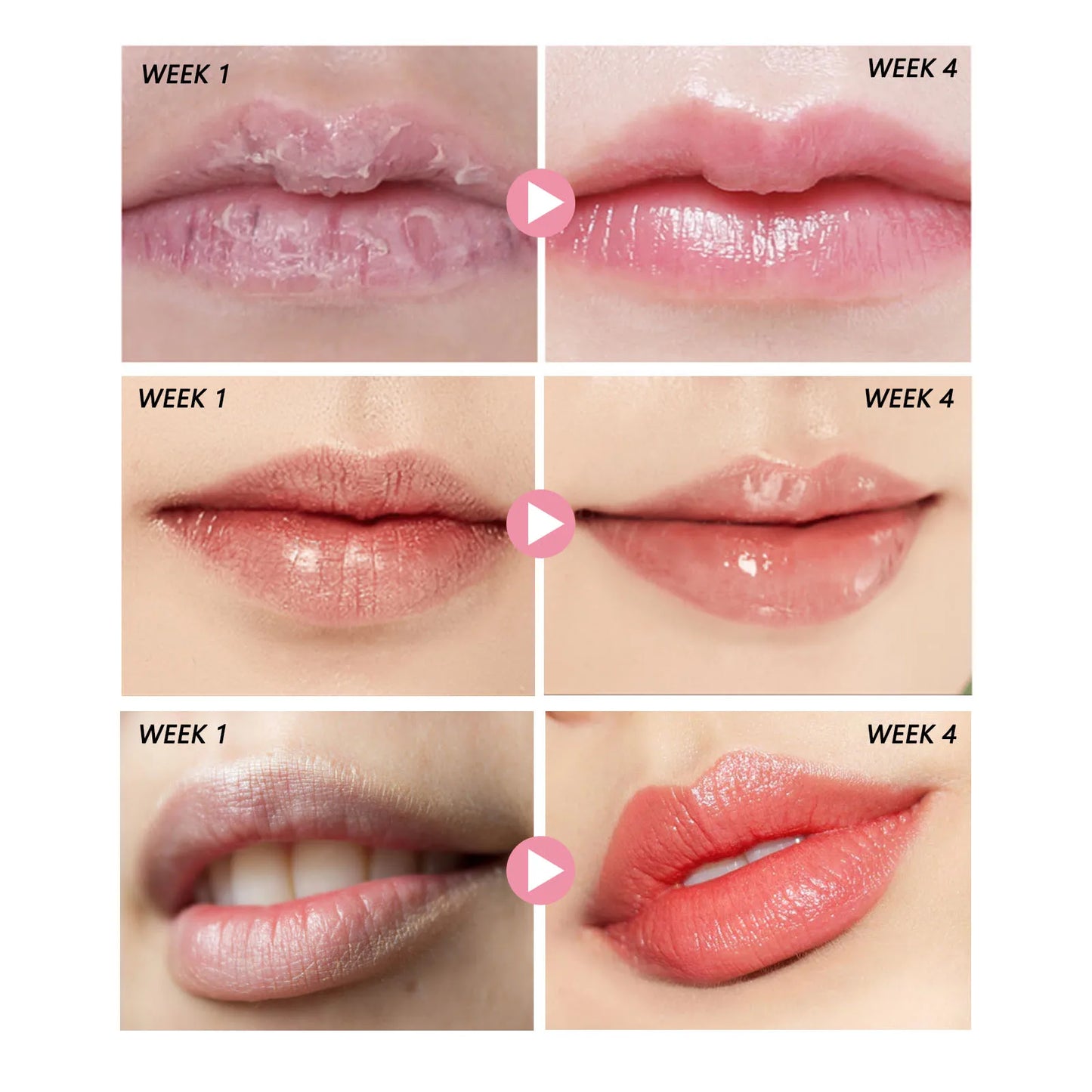 Peach Lip Scrub – Exfoliating, Moisturizing & Dark Lip Care 30g