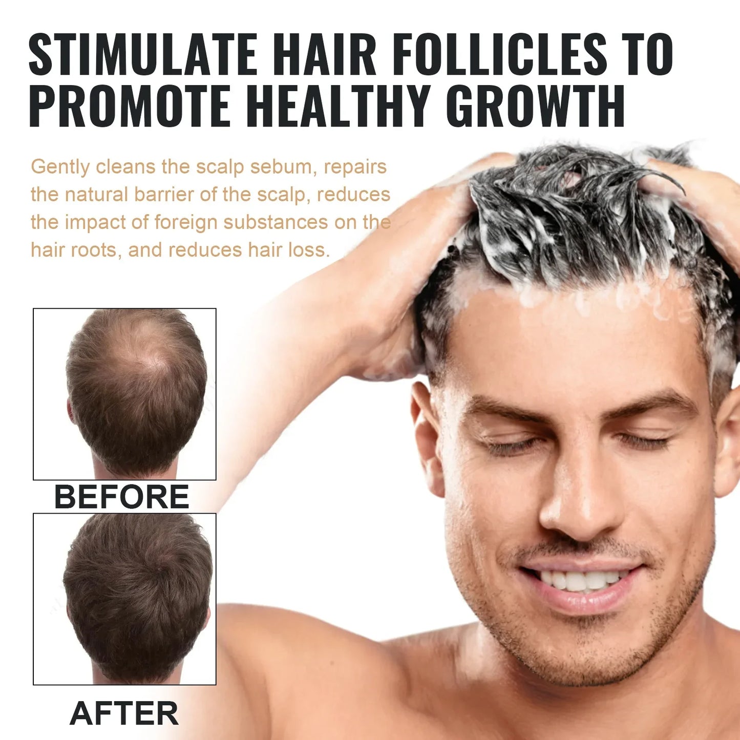 EELHOE Hair Loss Shampoo – Growth, Thickening & Scalp Repair