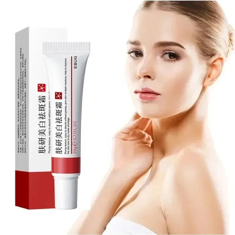 1/3/5pcs Whitening Freckle Cream Niacinamide Remove Dark Spot Cream Anti Freckle and Aging Cream Fade Pigmentation Melasma Skin Peaceful Pleasures Health and Wellness