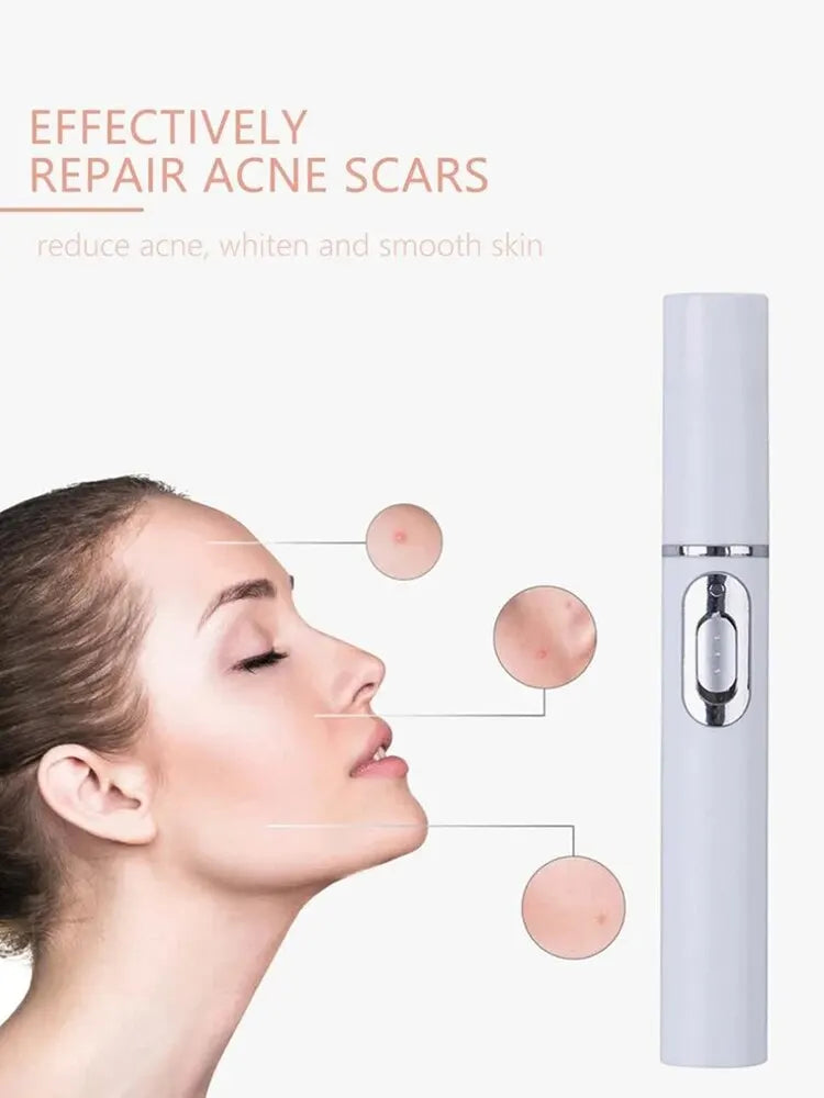 Facial Beauty Device Eye Massager Blue Light Black Eye Circles Facial Care Tool Lightening Texture Maintaining Eye Bags Peaceful Pleasures Health and Wellness