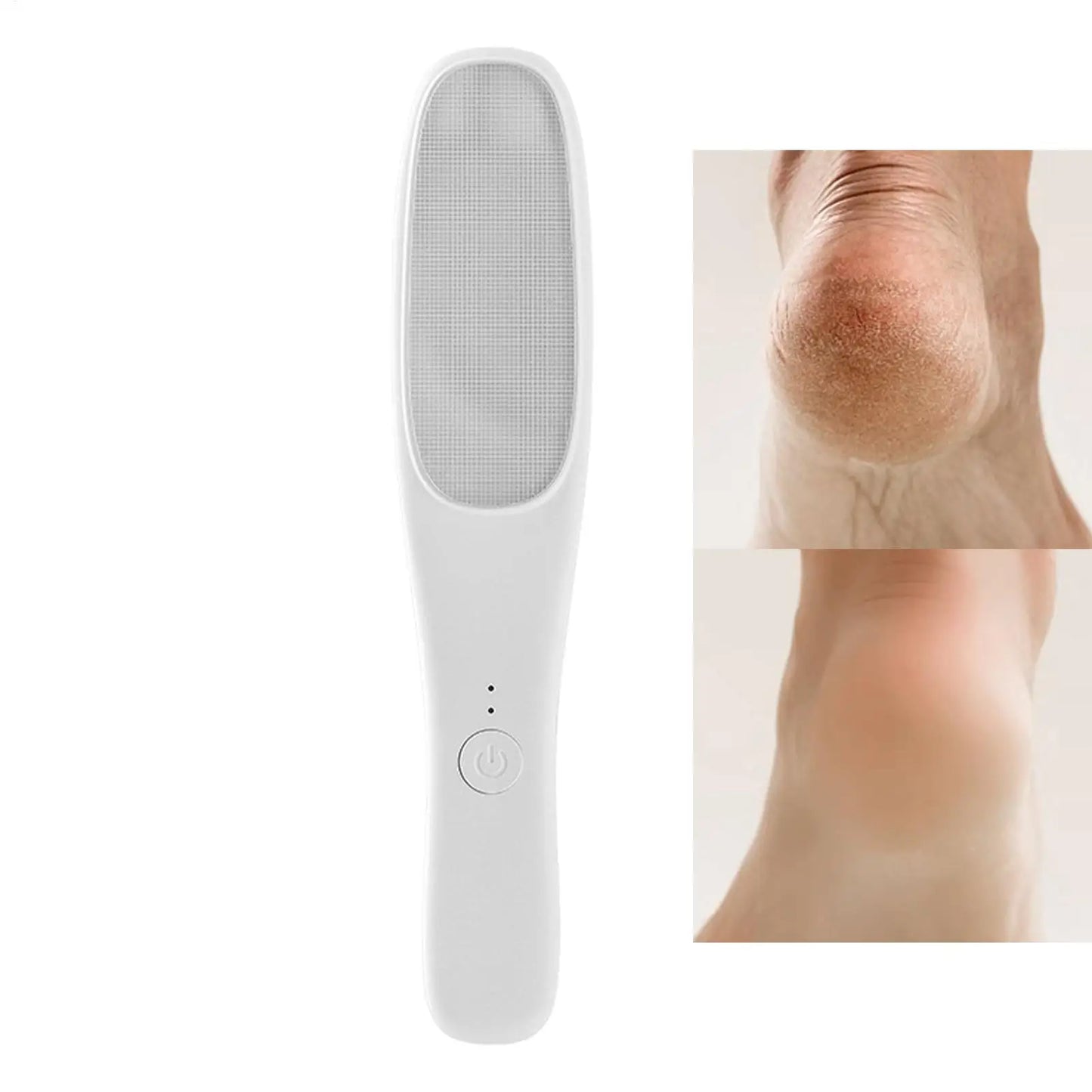 Electric Foot Callus Remover – Rechargeable 6-Speed Foot File