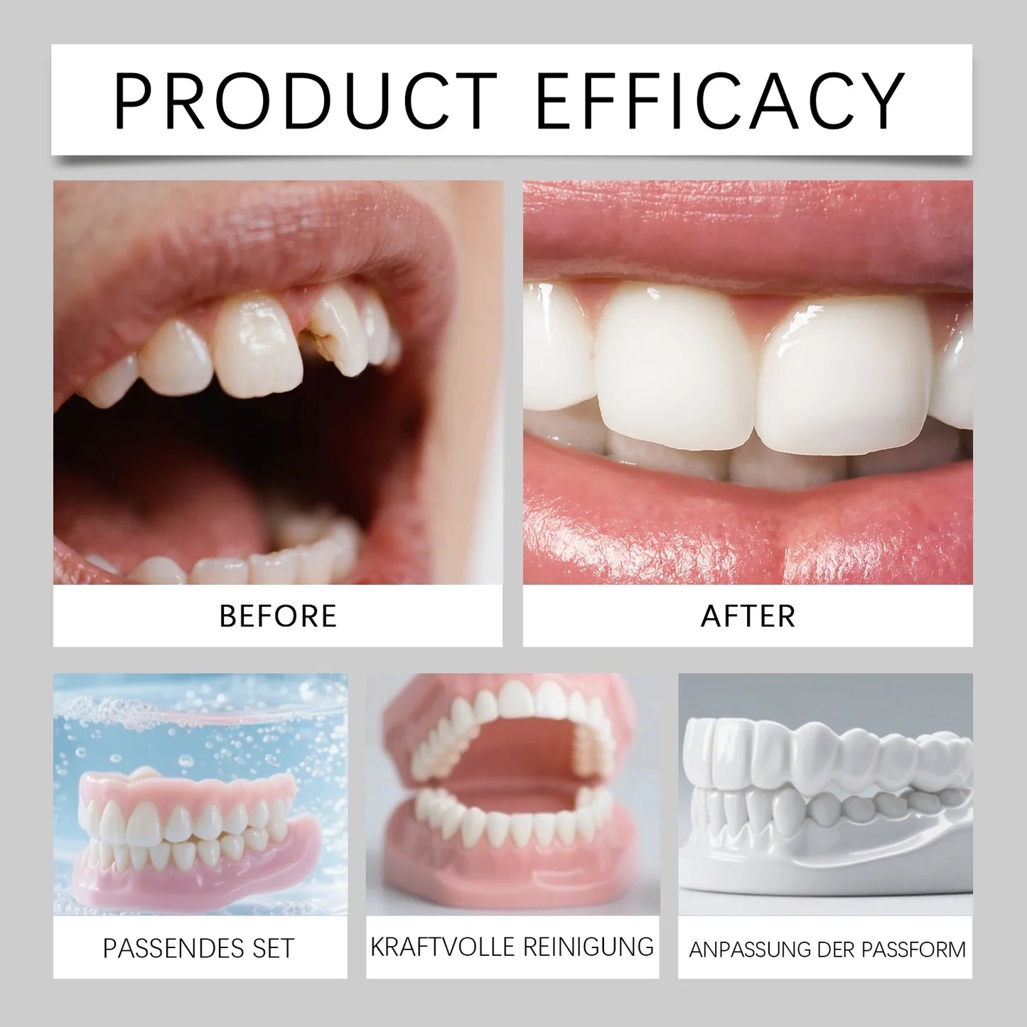 DIY Temporary Smile Veneers – Upper & Lower Cosmetic Denture Kit