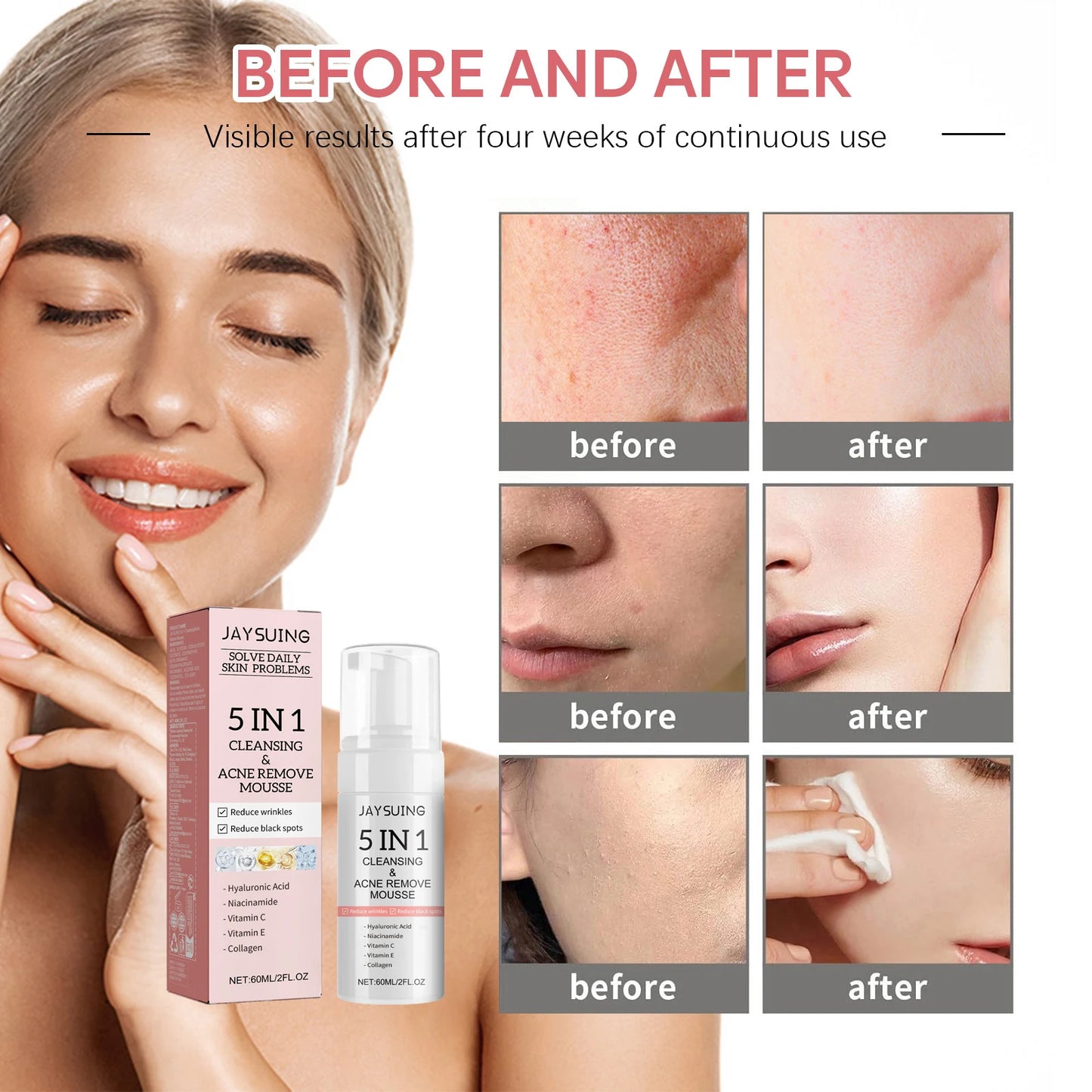 5-in-1 Hyaluronic Acid Foam Facial Cleanser | K-Beauty