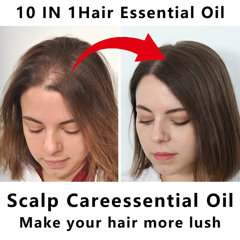 YUITIKUE 10-IN-1 Castor Seed Hair Oil | Blended With Rosemary, Batana Oil, Biotin & Keratin | For Multi-Nourishment Hair Care Peaceful Pleasures Health and Wellness