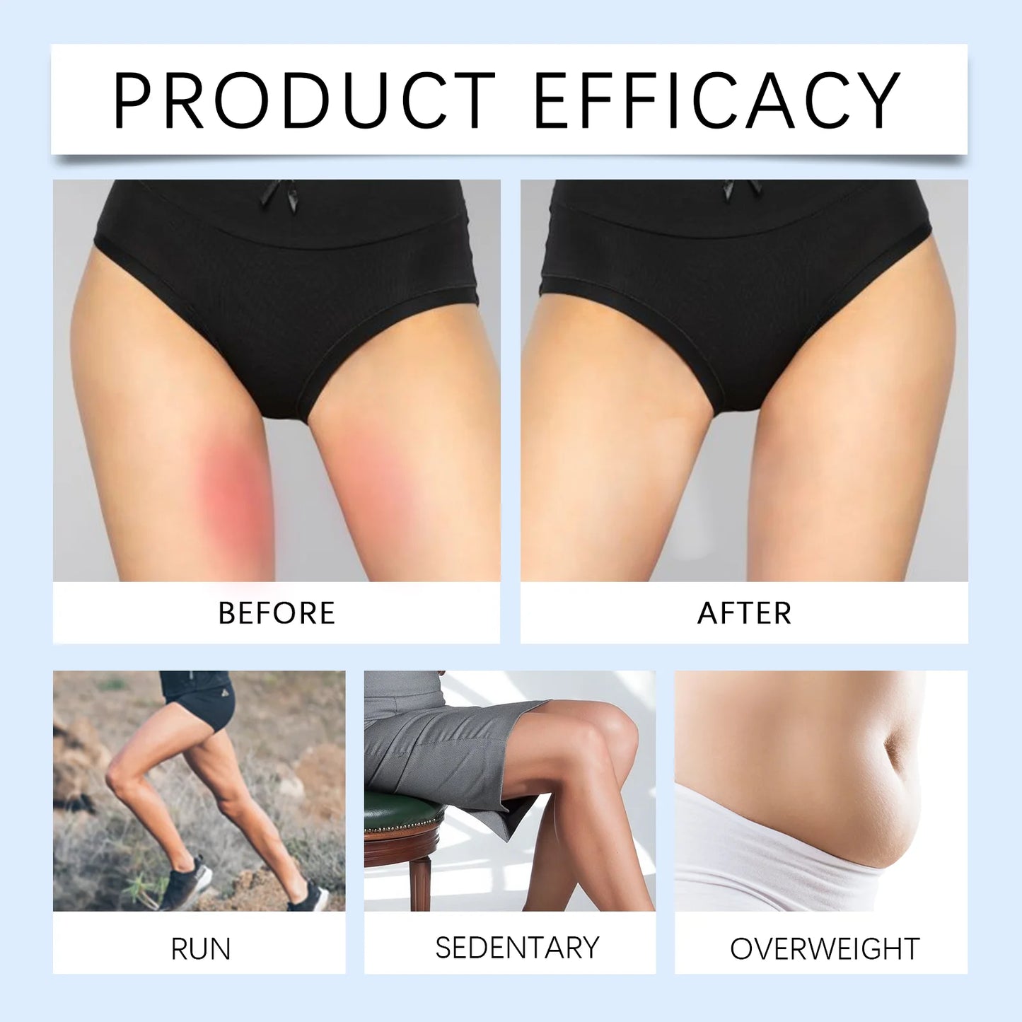 Invisible Anti-Chafing Thigh Patches – 10 Pack Waterproof