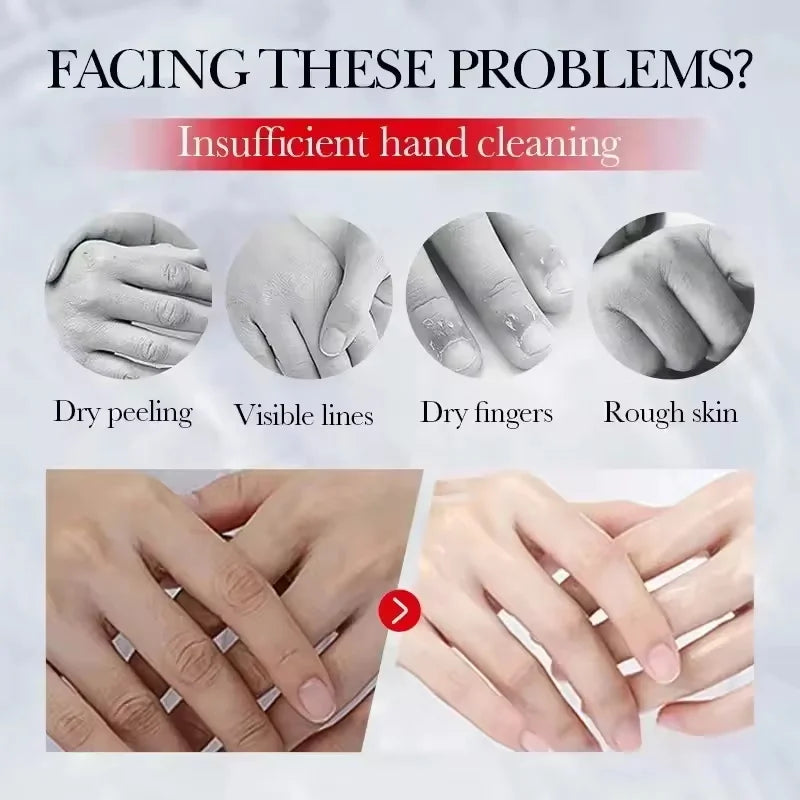 Dark Knuckle Brightening Hand Cream | Melanin Corrector 30g