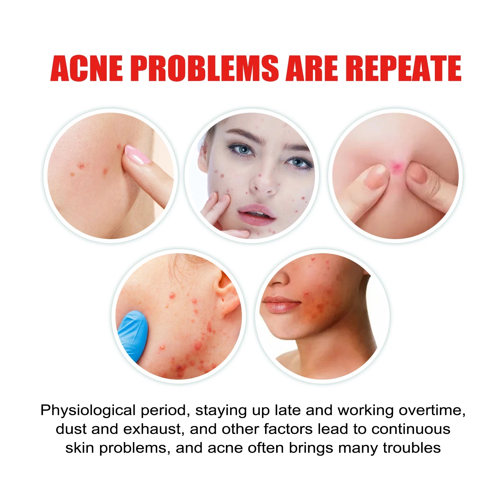 200PCS Cloud Acne Spot Patches Fade Imperfections Cover Pimples Hydrogel Invisible Acne Scar Fading Tool Skincare Tool Peaceful Pleasures Health and Wellness