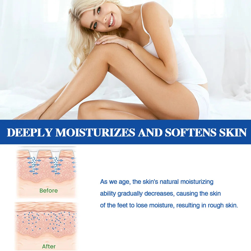 Heel Repair Foot Cream – Anti-Crack & Dead Skin Removal Peaceful Pleasures Health and Wellness