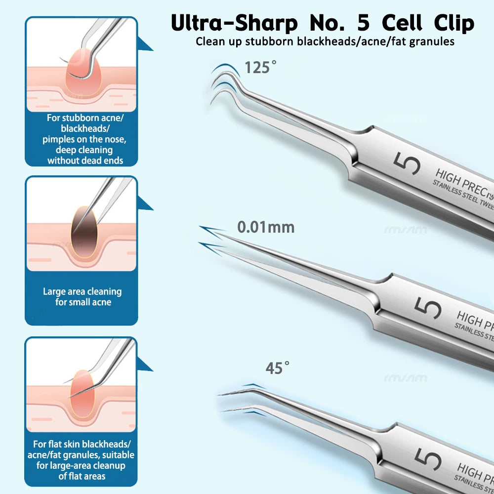 German Ultra-fine No. 5 Cell Pimples Blackhead Clip Tweezers Beauty Salon Special Facial Pore Cleaning Acne Wart Skin Care Tools Peaceful Pleasures Health and Wellness