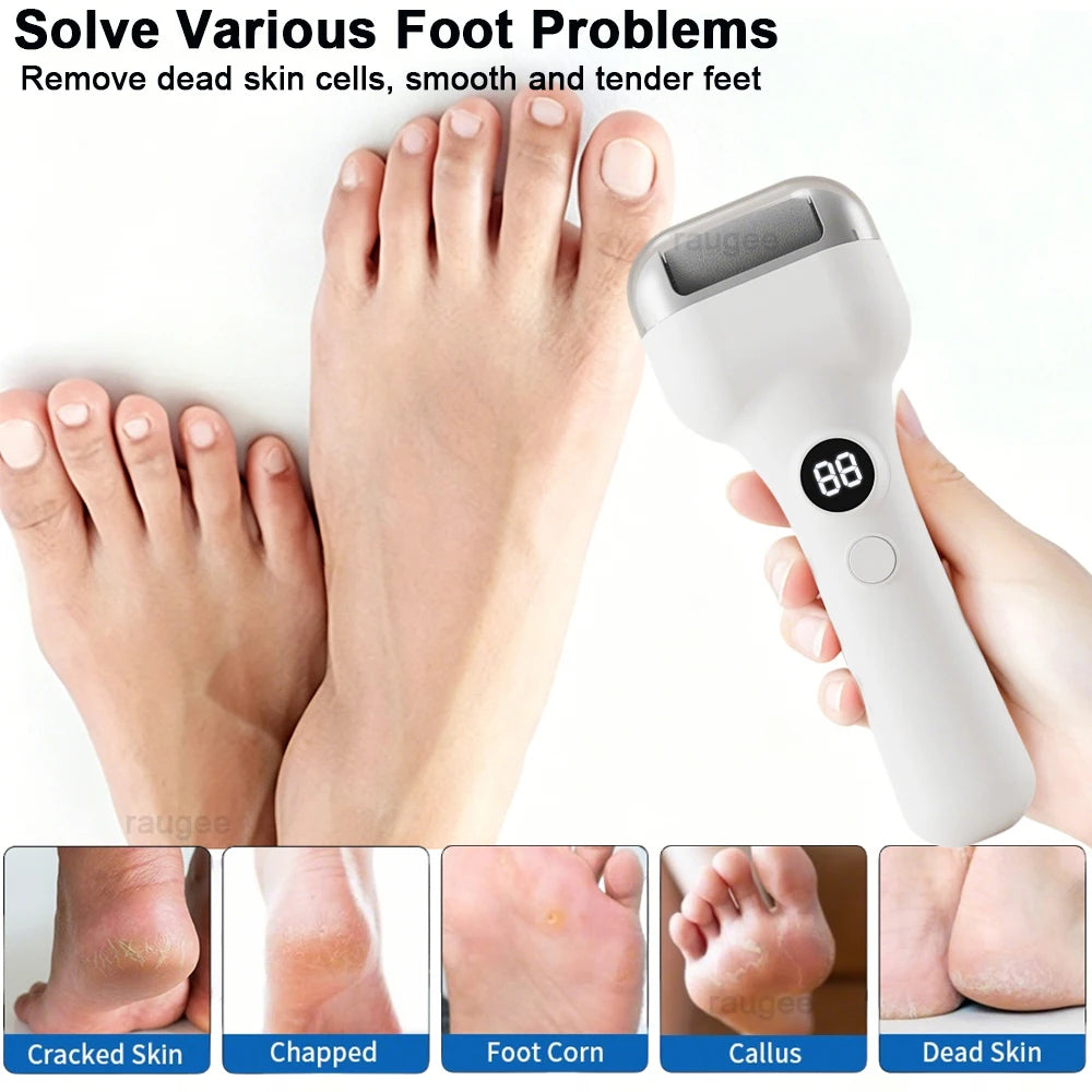 Electric Foot Grinder Automatic Electric Callus Remover for Feet Rechargeable Electric Foot File Pedicure Tool Dead Skin Remover Peaceful Pleasures Health and Wellness