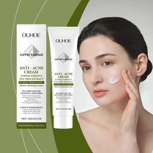 OUHOE Herbal Anti-Acne Cream – Blemish & Pore Treatment 15g Herbal Acne Cream Oasis Select
