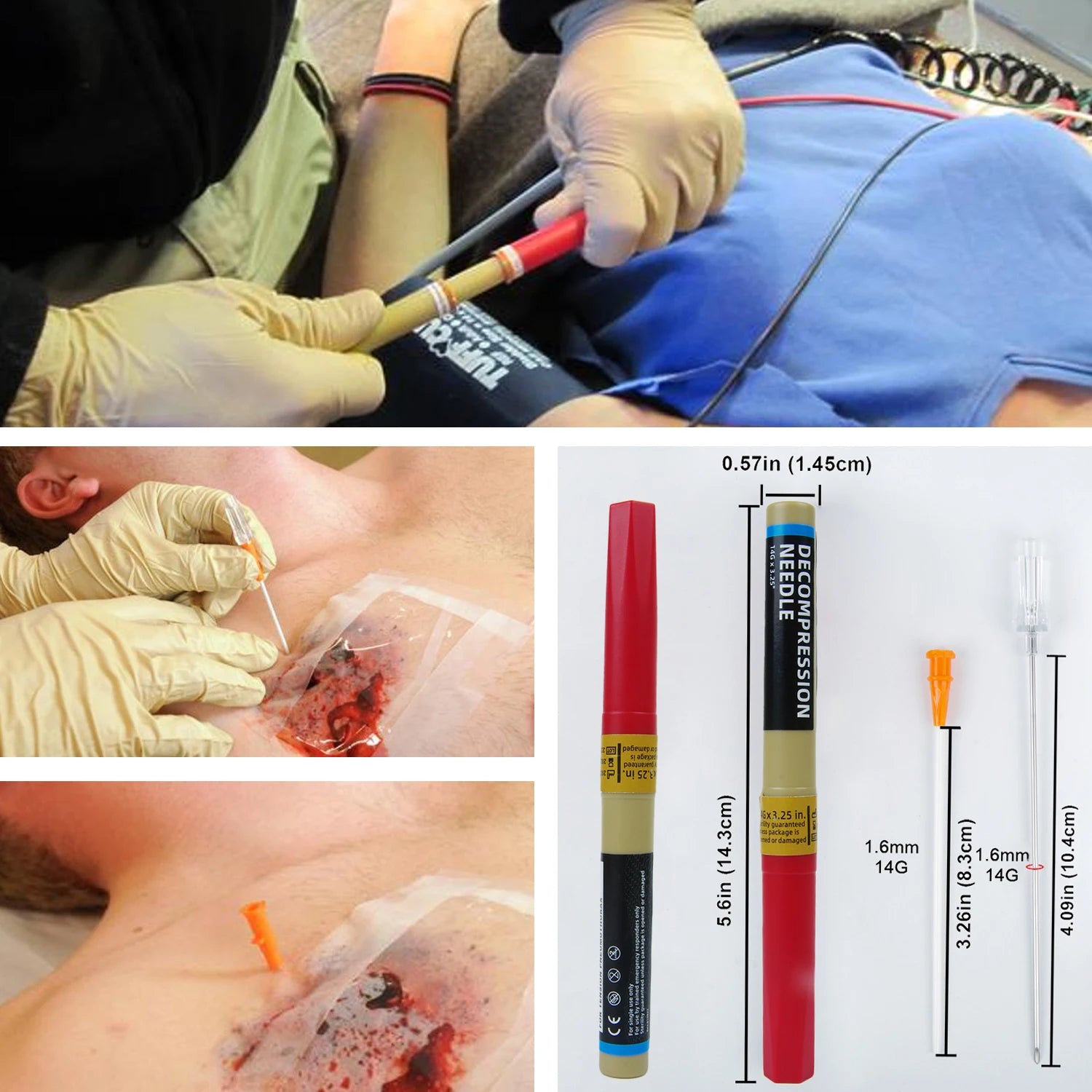 Sanke Rescue Pneumothorax Needle Trauma Medical IFAK Chest Catheter Needlecatheter 50g Needle Decompression EDC First Aid Kit Peaceful Pleasures Health and Wellness