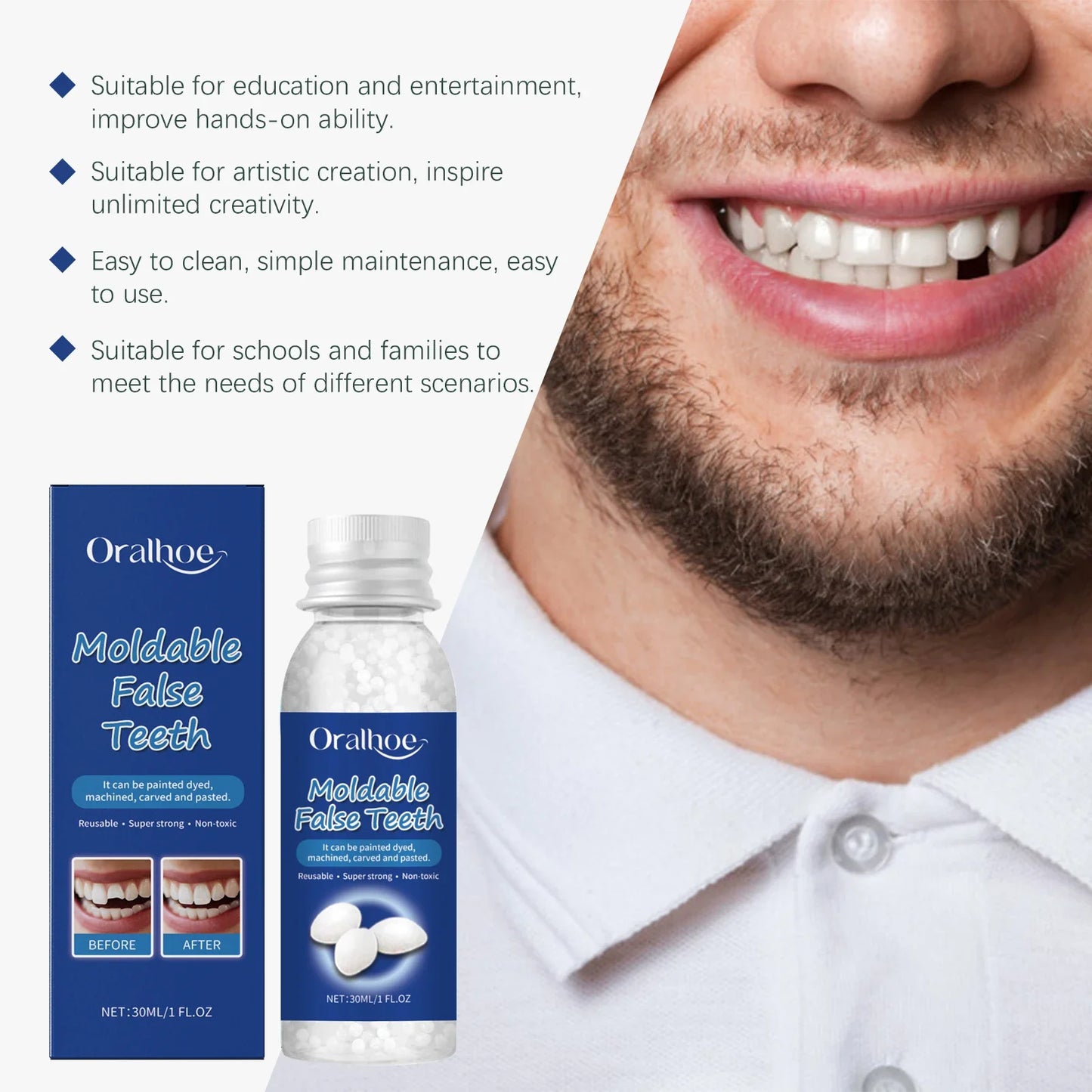 Oralhoe Temporary Tooth Repair Kit – Moldable Resin Dental Glue