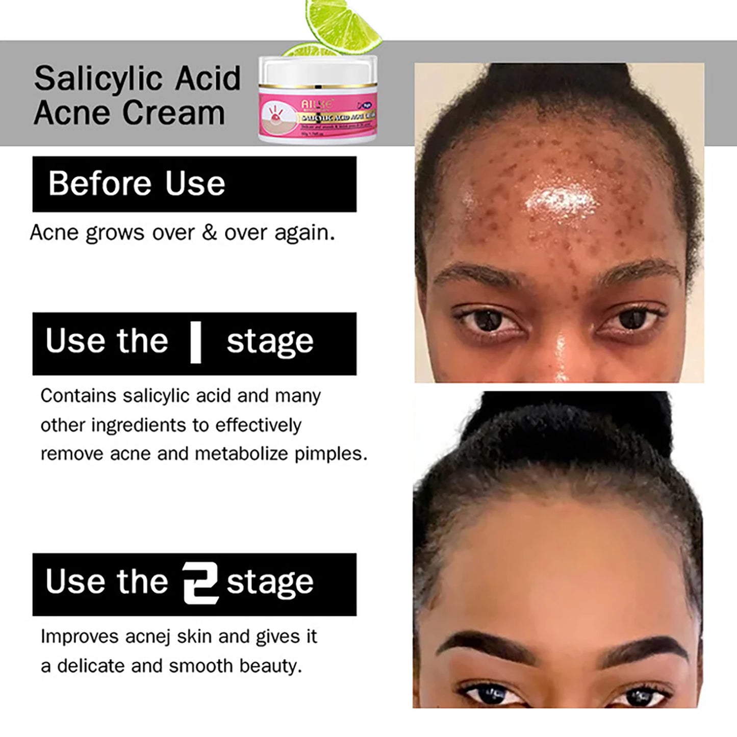 AILKE Organic Acne Face Cream – Oil Control & Brightening 50ml