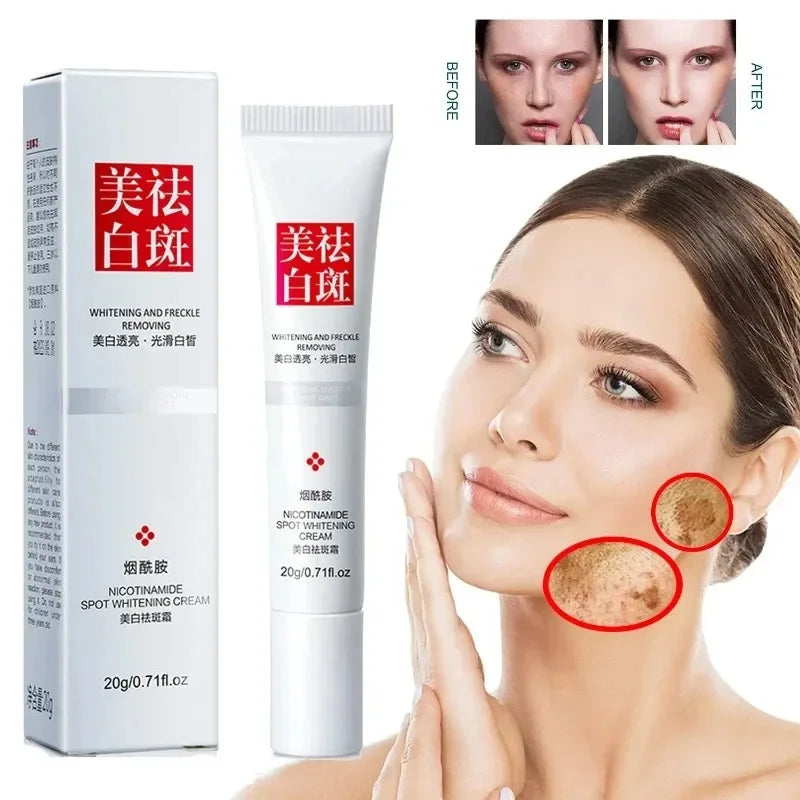 LGRAMER Whitening Cream – Fades Dark Spots, Freckles & Melanin