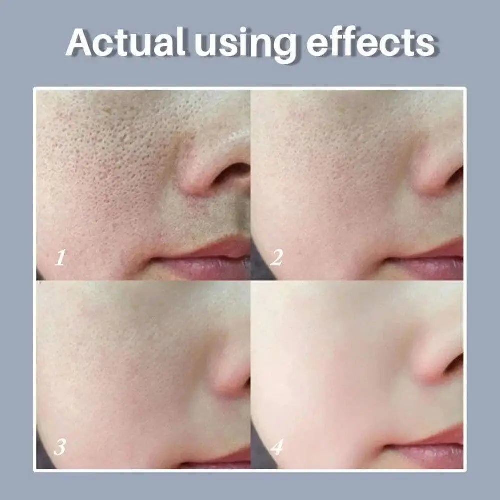 Acidity Pore Shrink Face Serum Remove Blackhead Acne Spot Oil Control Moisturizing Repair Nourish Pores Firming Smooth Skin Care Peaceful Pleasures Health and Wellness