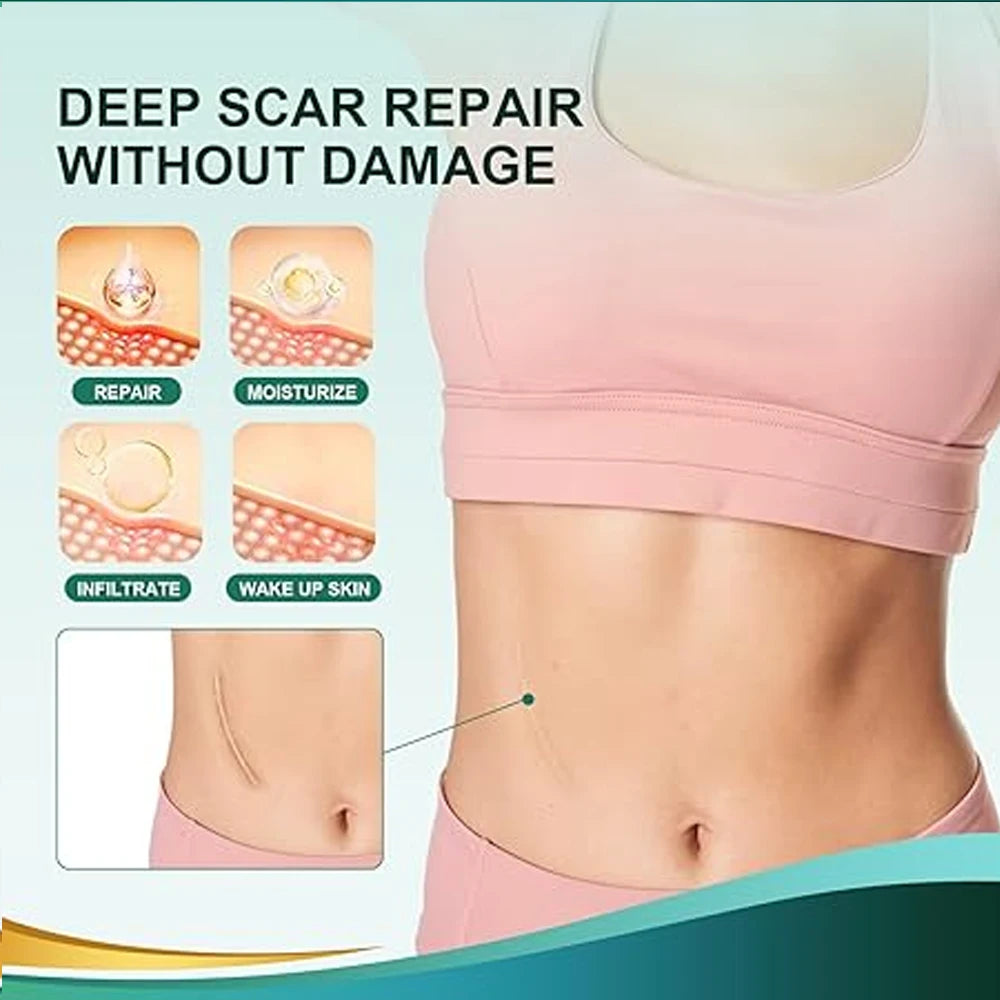 Silicone Scar Tape Roll – Keloid, Surgical & Acne Scar Sheets Silicone Scar Tape Peaceful Pleasures Health and Wellness