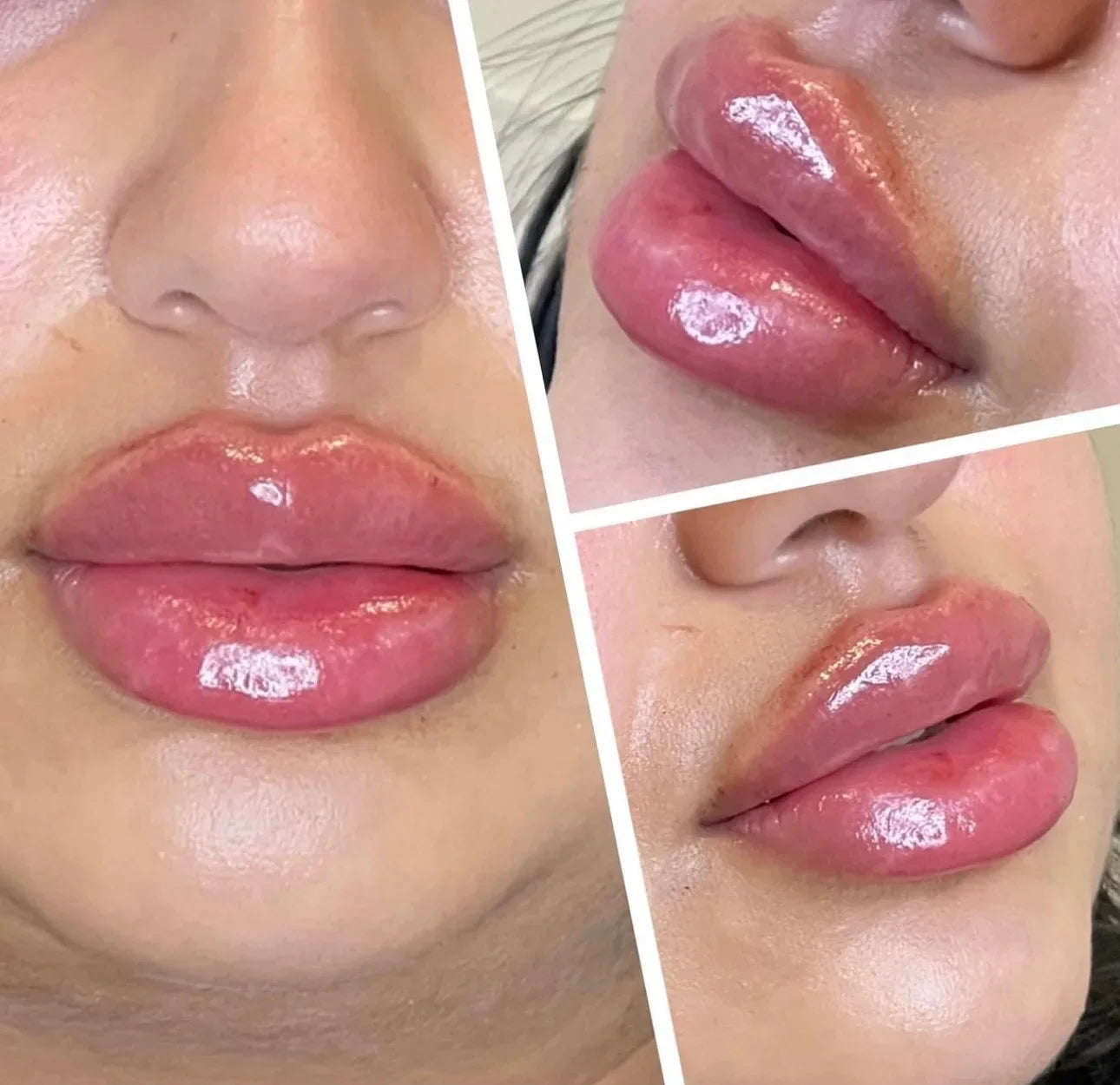 Spicule Lip Plumper Serum – Instantly Fuller & Moisturized Lips